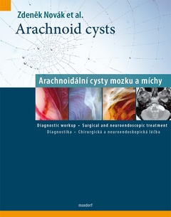 obálka: Arachnoid cysts