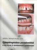 obálka: Etiopatogenéza parodontitíd a ich vzťah k systémovým ochoreniam
