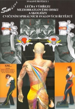 obálka: Léčba výhřezu meziobratlového disku bez operace
