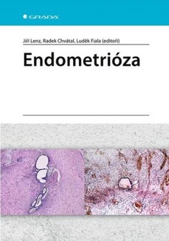 obálka: Endometrióza