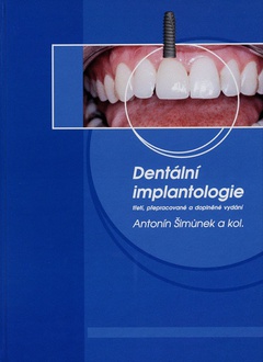 obálka: Dentální implantologie