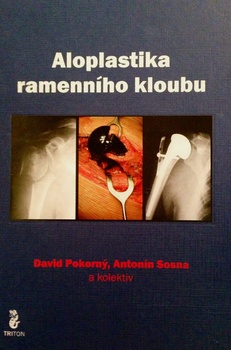 obálka: ALOPLASTIKA RAMENNÍHO KLOUBU