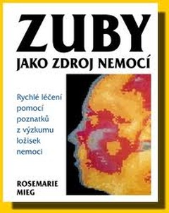 obálka: Zuby jako zdroj nemocí