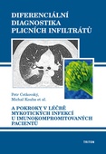 obálka: Diferenciální diagnostika plicních infiltrátů