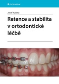 obálka: Retence a stabilita v ortodontické léčbě