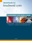 obálka: Arachnoid cysts