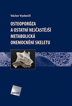 obálka: Osteoporóza a ostatní nejčastější metabolická onemocnění skeletu