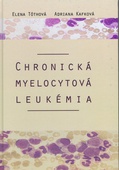 obálka: Chronická myelocytová leukémia