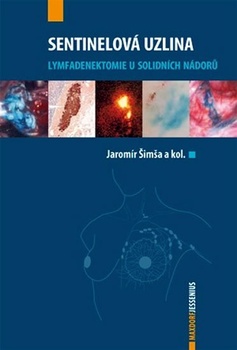 obálka: Sentinelová uzlina