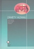 obálka: Záněty hltanu